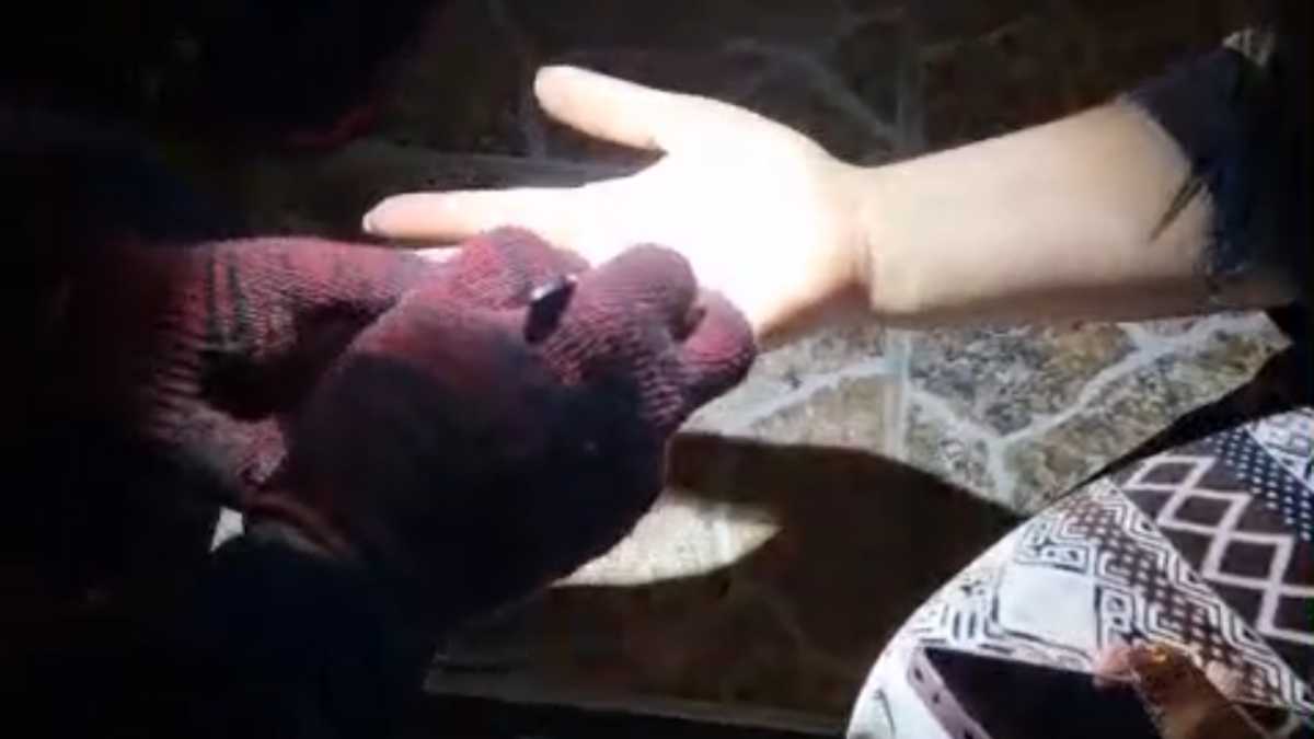 Спасатели помогли женщине снять застрявшее кольцо в Алматинской области 