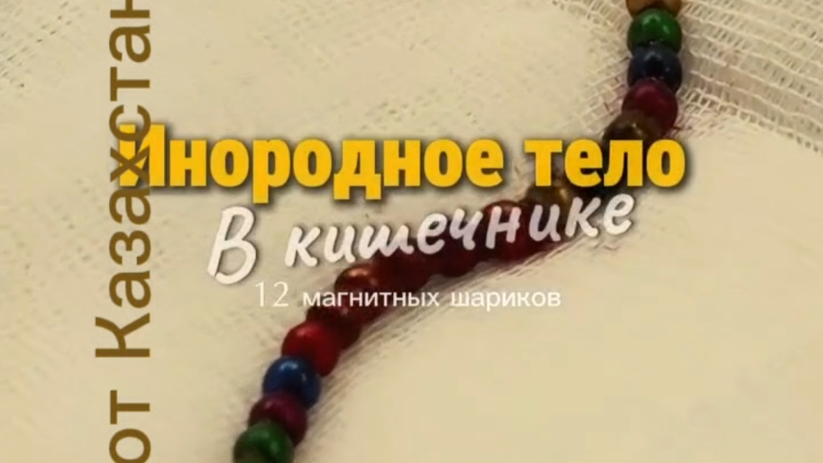 Ребенок едва не погиб из-за магнитных шариков в Караганде 