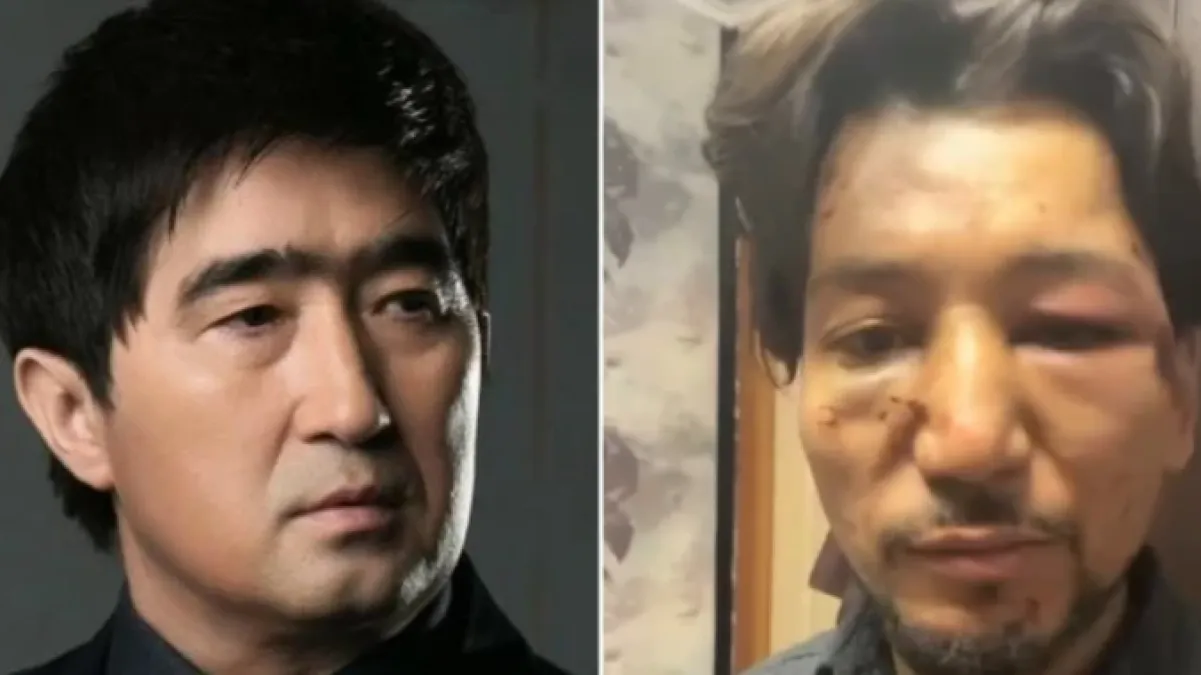 Мұқасан Шахзадаев жас әншіні аяусыз ұрып-соққан