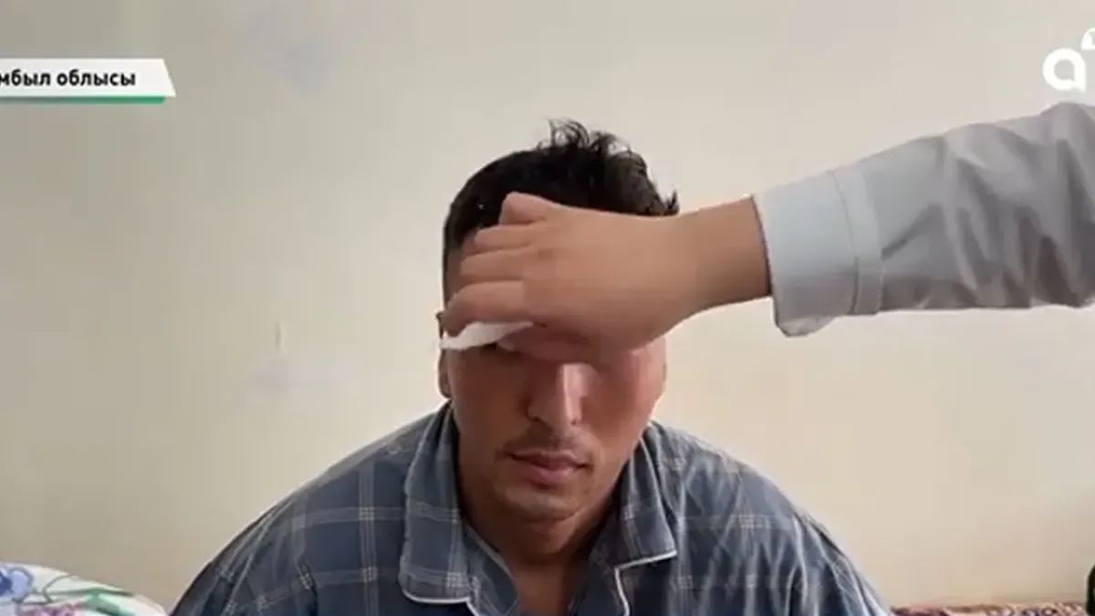 Жамбыл облысында әскери қызметкер басына бөтелке жарам деп жанарын жарақаттады